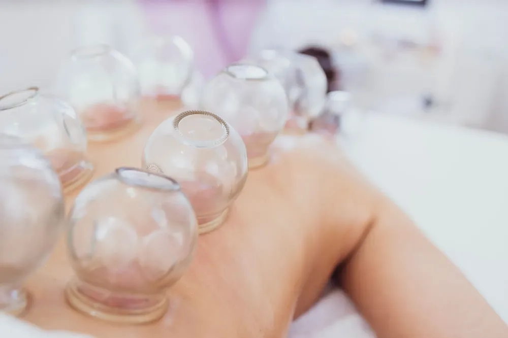 cupping therapy à Voiron
